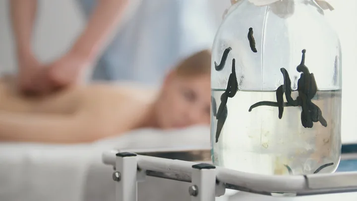 Hirudoterapia w łagodzeniu bólu stawów – czy pijawki mogą pomóc w chorobach reumatycznych?